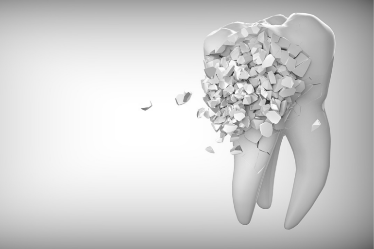 What Do You Do About A Broken Tooth?