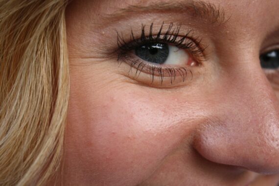How To Get Rid Of Neck Wrinkles