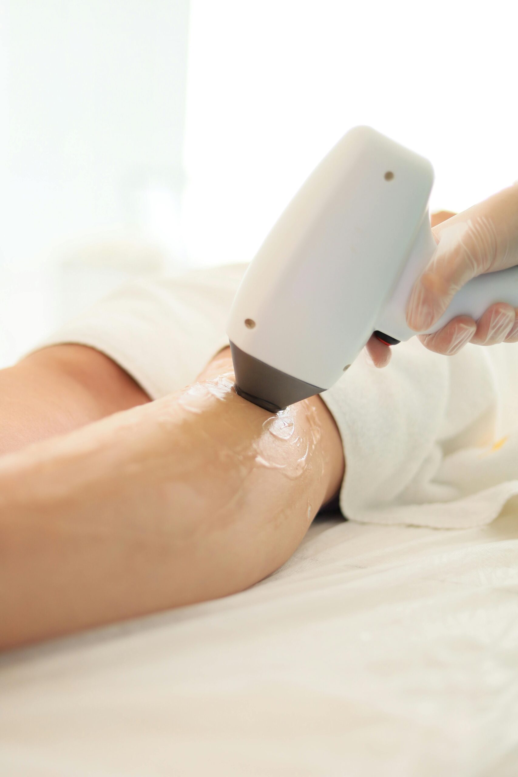 What Are the Long-Term Benefits of Laser Hair Removal?